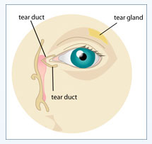 Dry Eye Syndrome