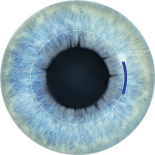 3D image of a blue eyeball