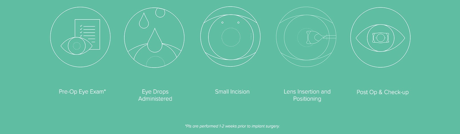Visian EVO ICL Surgical Procedure explanation