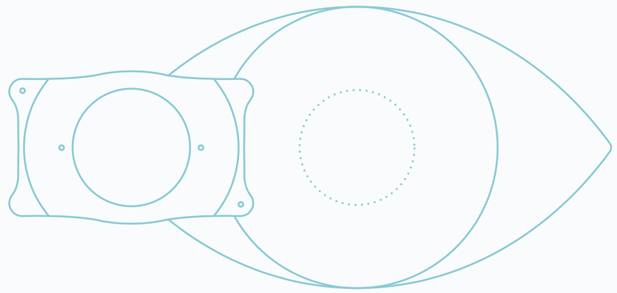 Visian EVO ICL contact next to eye
