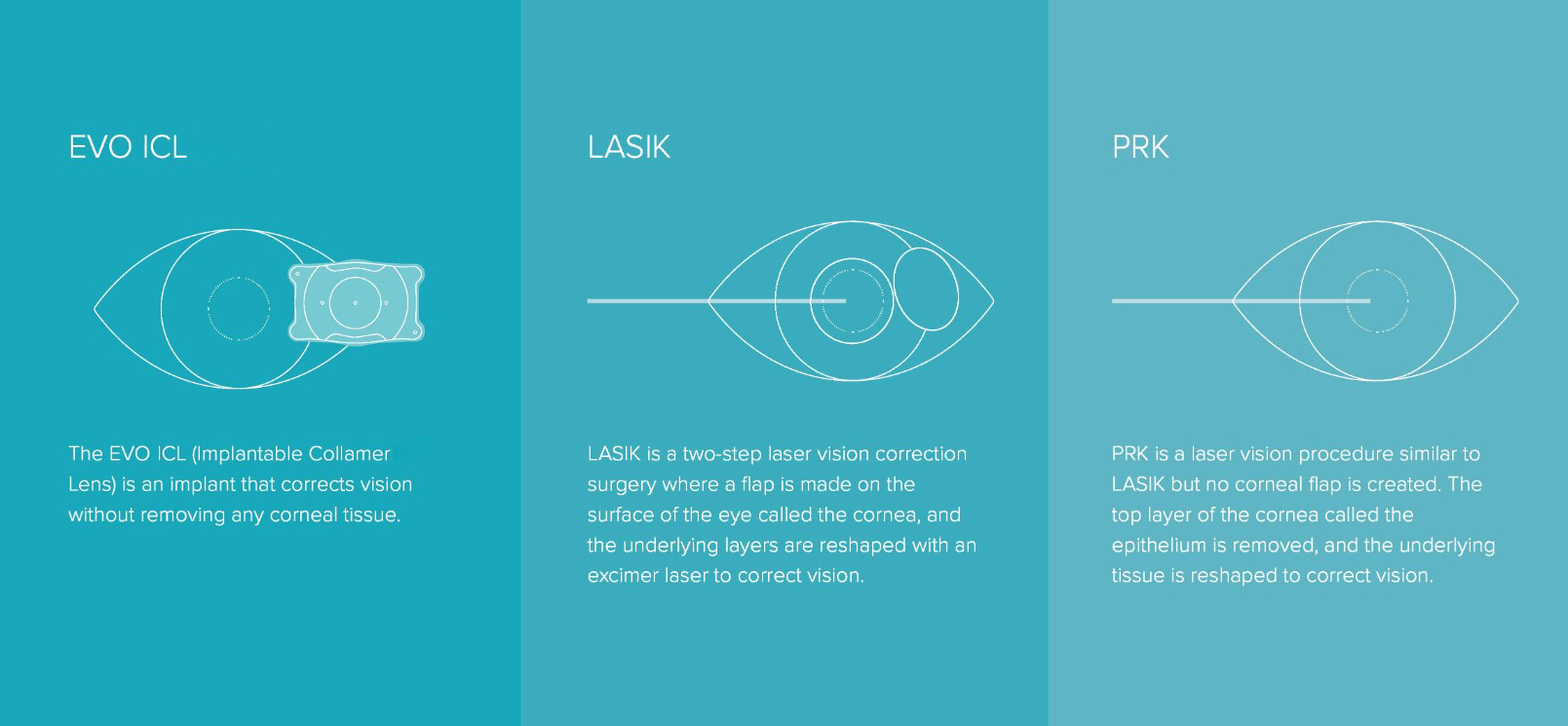 EVO ICL, LASIK & PRK CHART