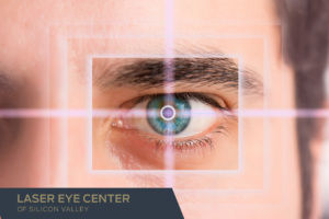 Close up of an eye with a laser focused onto the pupil for A Guide to Modern Vision Correction blog
