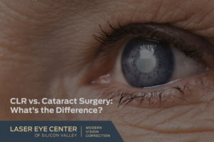 Close-up of blue eye for CLR vs. Cataract Surgery What’s the Difference blog